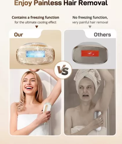 merkloos Hair Removal Device - Laser Hair Removal - Hair Removal - Men and Women - Full Body - Long Lasting Hair Removal (6151011331356)